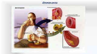 Факторы риска:
 