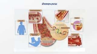 Факторы риска:
 