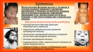 Кретинизм.
Недостаточная функция железы у человека в
детском возрасте приводит к развитию
кретинизма. У больных отмечается задержка
роста и полового развития, нарушения
пропорции тела, значительная отсталость
психики. У них часто открыт рот с высунутым
языком.
Кретинизм может возникнуть вследствие:
• наследственного фактора (реакции
тиреотропного гормона);
• нарушения эмбрионального развития
щитовидной железы;
• гипоплазии щитовидной железы и атириоза
(отсутствие щитовидной железы);
• эктопии щитовидной железы;
• эндемического зоба, перенесенного матерью во
время беременности.
• дефицита йода и селена, необходимых для
синтеза тиреоидных гормонов.
 
