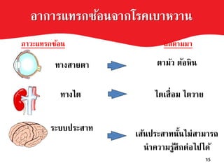 อาการแทรกซ้อนจากโรคเบาหวาน
ภาวะแทรกซ้อน ผลตามมา
เส้นประสาทนั้นไม่สามารถ
นาความรู้สึกต่อไปได้
ตามัว ต้อหิน
ไตเสื่อม ไตวาย
ทางสายตา
15
ทางไต
ระบบประสาท
 