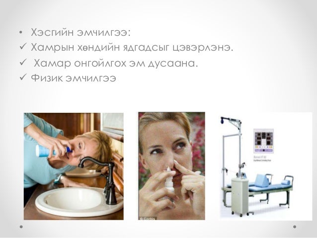 хамрын цочмог ба архаг үрэвсэл, вазомотор ринит