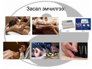 Засал эмчилгээ:
 