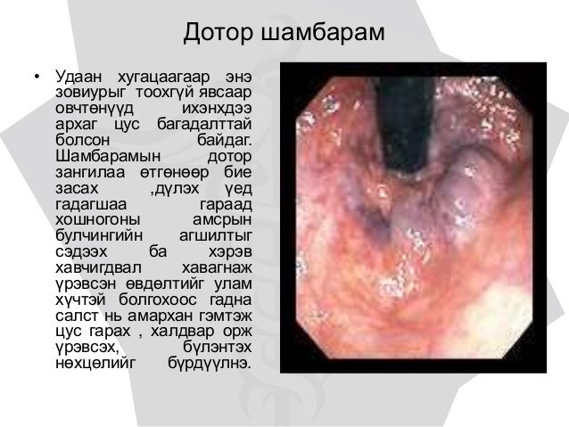 хамт төрсөн яр өвчнүүд