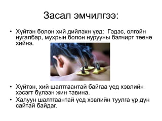 Засал эмчилгээ:
• Хүйтэн болон хий дийлэхн үед: Гэдэс, олгойн
нугалбар, мухрын болон нурууны бэлчирт төөнө
хийнэ.
• Хүйтэн, хий шалтгаантай байгаа үед хэвлийн
хэсэгт бүлээн жин тавина.
• Халуун шалтгаантай үед хэвлийн туулга үр дүн
сайтай байдаг.
 