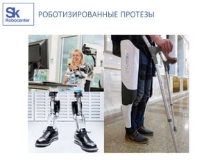 РОБОТИЗИРОВАННЫЕ ПРОТЕЗЫ
 