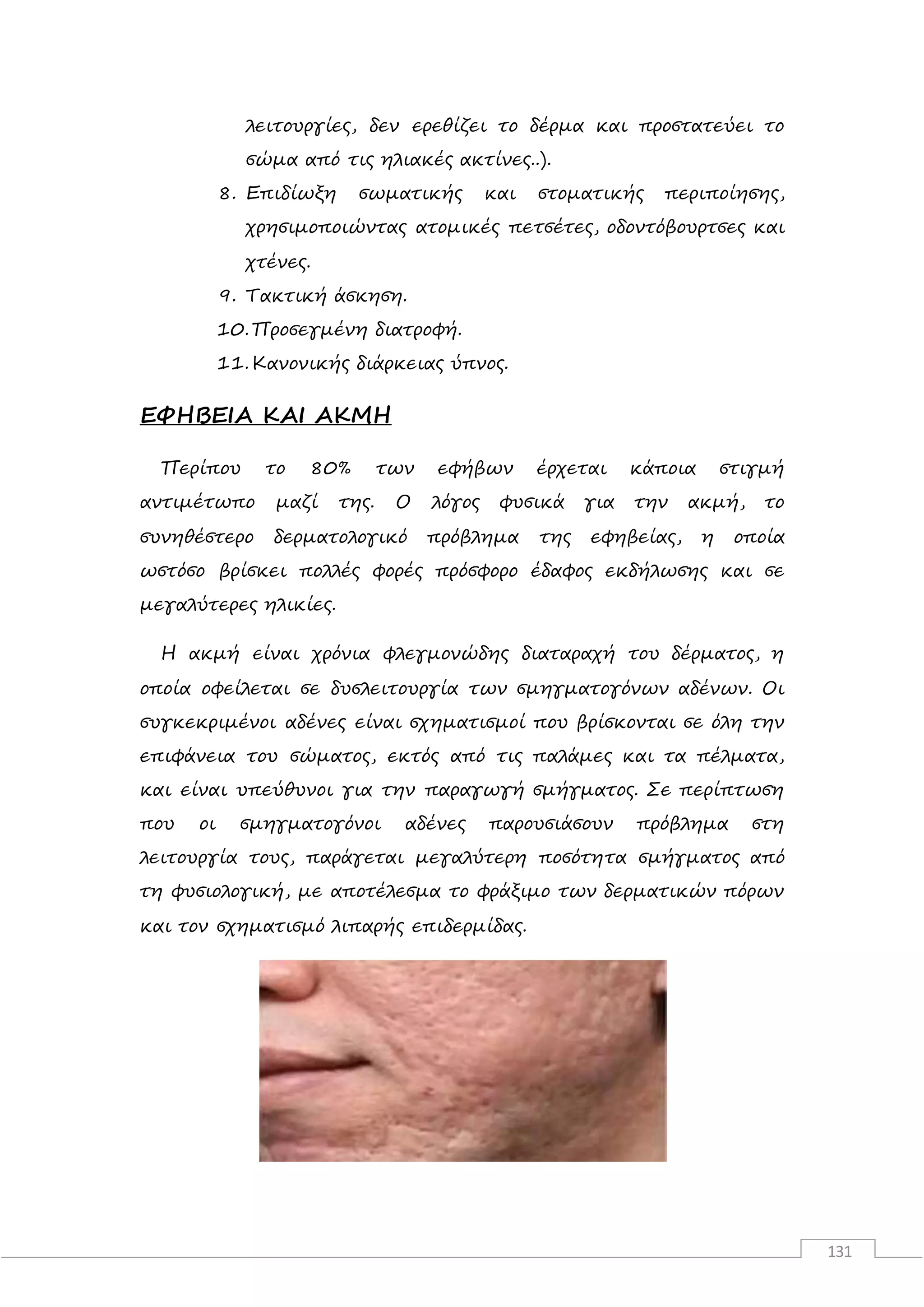 131
λειτουργίες, δεν ερεθίζει το δέρμα και προστατεύει το
σώμα από τις ηλιακές ακτίνες..).
8. Επιδίωξη σωματικής και στοματικής περιποίησης,
χρησιμοποιώντας ατομικές πετσέτες, οδοντόβουρτσες και
χτένες.
9. Τακτική άσκηση.
10.Προσεγμένη διατροφή.
11.Κανονικής διάρκειας ύπνος.
ΕΦΗΒΕΙΑ ΚΑΙ ΑΚΜΗ
Περίπου το 80% των εφήβων έρχεται κάποια στιγμή
αντιμέτωπο μαζί της. Ο λόγος φυσικά για την ακμή, το
συνηθέστερο δερματολογικό πρόβλημα της εφηβείας, η οποία
ωστόσο βρίσκει πολλές φορές πρόσφορο έδαφος εκδήλωσης και σε
μεγαλύτερες ηλικίες.
Η ακμή είναι χρόνια φλεγμονώδης διαταραχή του δέρματος, η
οποία οφείλεται σε δυσλειτουργία των σμηγματογόνων αδένων. Οι
συγκεκριμένοι αδένες είναι σχηματισμοί που βρίσκονται σε όλη την
επιφάνεια του σώματος, εκτός από τις παλάμες και τα πέλματα,
και είναι υπεύθυνοι για την παραγωγή σμήγματος. Σε περίπτωση
που οι σμηγματογόνοι αδένες παρουσιάσουν πρόβλημα στη
λειτουργία τους, παράγεται μεγαλύτερη ποσότητα σμήγματος από
τη φυσιολογική, με αποτέλεσμα το φράξιμο των δερματικών πόρων
και τον σχηματισμό λιπαρής επιδερμίδας.
 