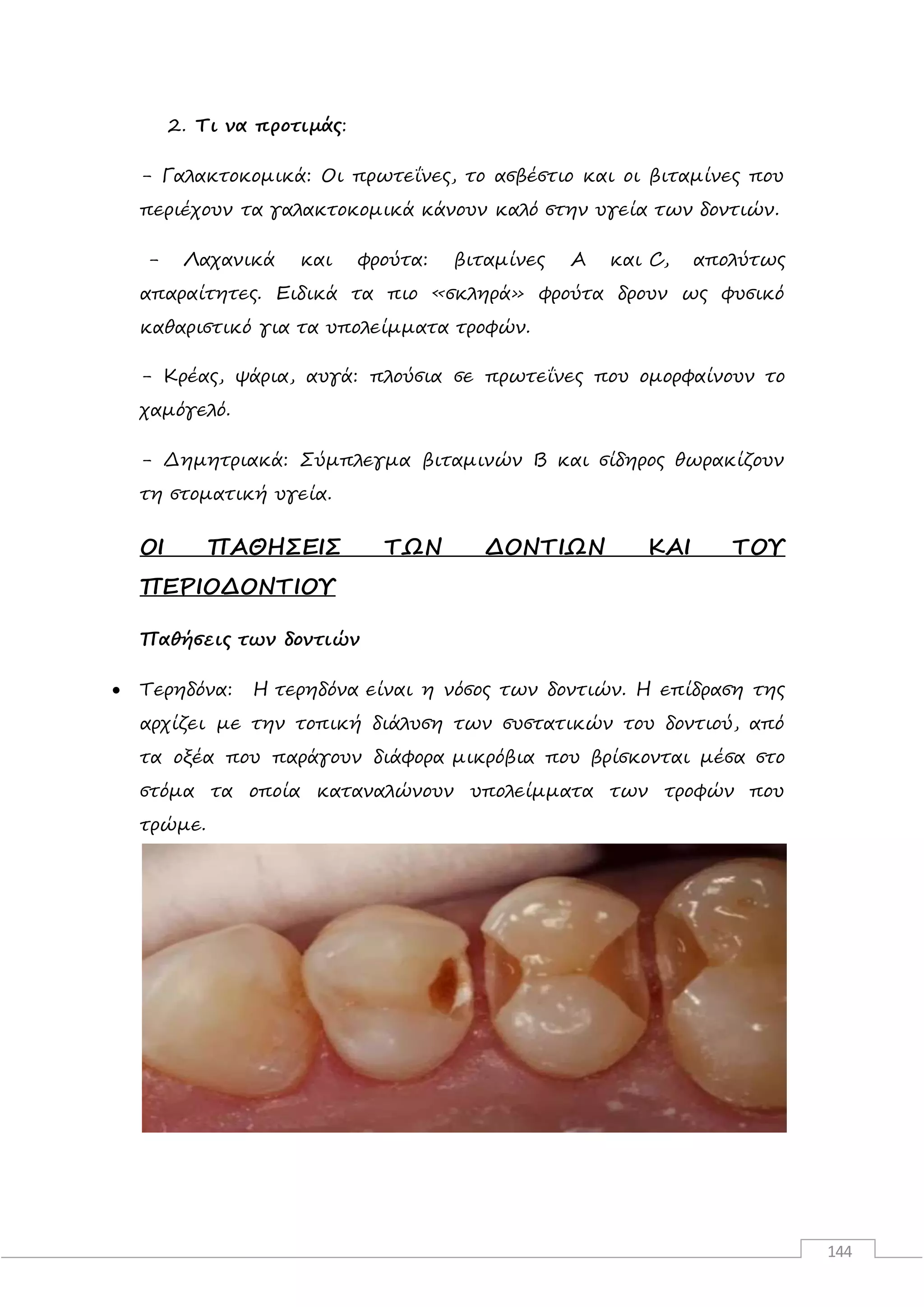 144
2. Τι να προτιμάς:
- Γαλακτοκομικά: Οι πρωτεΐνες, το ασβέστιο και οι βιταμίνες που
περιέχουν τα γαλακτοκομικά κάνουν καλό στην υγεία των δοντιών.
- Λαχανικά και φρούτα: βιταμίνες Α και C, απολύτως
απαραίτητες. Ειδικά τα πιο «σκληρά» φρούτα δρουν ως φυσικό
καθαριστικό για τα υπολείμματα τροφών.
- Κρέας, ψάρια, αυγά: πλούσια σε πρωτεΐνες που ομορφαίνουν το
χαμόγελό.
- Δημητριακά: Σύμπλεγμα βιταμινών Β και σίδηρος θωρακίζουν
τη στοματική υγεία.
ΟΙ ΠΑΘΗΣΕΙΣ ΤΩΝ ΔΟΝΤΙΩΝ ΚΑΙ ΤΟΥ
ΠΕΡΙΟΔΟΝΤΙΟΥ
Παθήσεις των δοντιών
 Τερηδόνα: Η τερηδόνα είναι η νόσος των δοντιών. Η επίδραση της
αρχίζει με την τοπική διάλυση των συστατικών του δοντιού, από
τα οξέα που παράγουν διάφορα μικρόβια που βρίσκονται μέσα στο
στόμα τα οποία καταναλώνουν υπολείμματα των τροφών που
τρώμε.
 