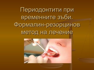 Периодонтити приПериодонтити при
временните зъби.временните зъби.
Формалин-резорциновФормалин-резорцинов
метод на лечениеметод на лечение
 