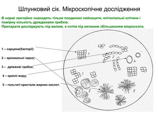 Шлунковий сік. Мікроскопічне дослідження
В нормі звичайно знаходять тільки поодинокі лейкоцити, епітеліальні клітини і
помірну кількість дріжджових грибків.
Препарати досліджують під малим, а потім під великим збільшенням мікроскопа.
1 – сарцини(бактерії)
2 – крохмальні зерна;
3 – дріжжові грибки;
4 – краплі жиру;
5 – гольчаті кристали жирних кислот.
 