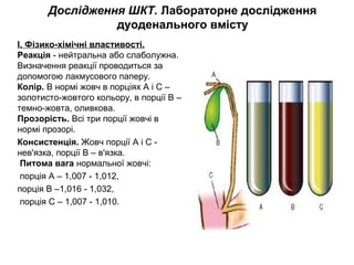 Дослідження ШКТ. Лабораторне дослідження
дуоденального вмісту
І. Фізико-хімічні властивості.
Реакція - нейтральна або слаболужна. 
Визначення реакції проводиться за 
допомогою лакмусового паперу. 
Колір. В нормі жовч в порціях А і С – 
золотисто-жовтого кольору, в порції В – 
темно-жовта, оливкова. 
Прозорість. Всі три порції жовчі в 
нормі прозорі. 
Консистенція. Жовч порції А і С - 
нев'язка, порції В – в'язка.
Питома вага нормальної жовчі:
 порція А – 1,007 - 1,012, 
порція В –1,016 - 1,032,
 порція С – 1,007 - 1,010.
 
