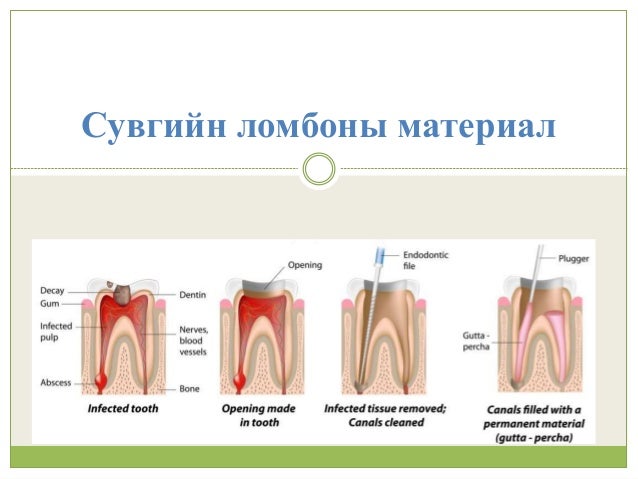 сувгийн ломбоны материал