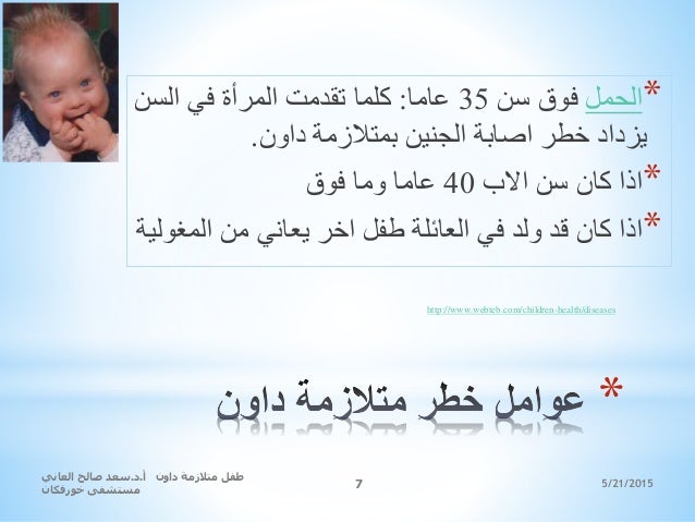 عرض بوربوينت متلازمة داون