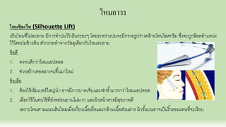 ไหมถาวร
ไหมซิลเว็ท (Silhouette Lift)
เป็นไหมทีไม่ละลาย มีการทําปมไว้เป็นระยะๆ โดยระหว่างปมจะมีกรวยรูปร่างคล้ายโคนไอศกรีม ซึงจะถูกล๊อคตําแหน่ง
ไว้โดยปมข้างต้น ตัวกรวยทําจากวัสดุเดียวกับไหมละลาย
ข้อดี
1. คงทนดีกว่าไหมแอปตอส
2. ช่วยสร้างคอลลาเจนขึนมาใหม่
ข้อเสีย
1. ต้องใช้เข็มเบอร์ใหญ่นํา อาจมีการบาดเจ็บและฟกชํามากกว่าไหมแอปตอส
2. เลือกใช้ในคนไข้ทียังหย่อนยานไม่มาก และผิวหน้าควรมีสุขภาพดี
เพราะโคนตามแนวเส้นไหมเมือเกียวเนือเยือและกล้ามเนือส่วนล่าง ผิวชันบนอาจเป็นริวรอยแทนทีจะเรียบ
 