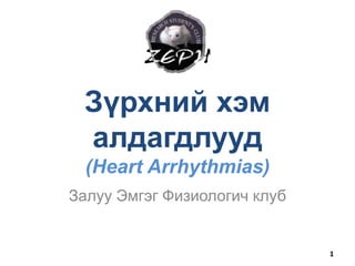 Зүрхний хэм
алдагдлууд
(Heart Arrhythmias)
Залуу Эмгэг Физиологич клуб
1
 