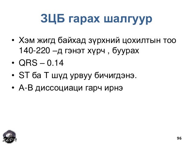 Зүрхний хэм алдагдал