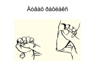 Àòãàõ ðåôëåêñ
 