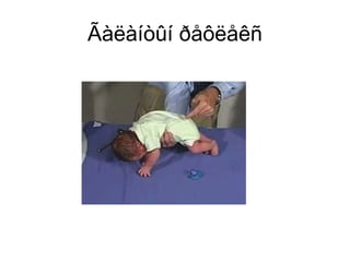 Ãàëàíòûí ðåôëåêñ
 