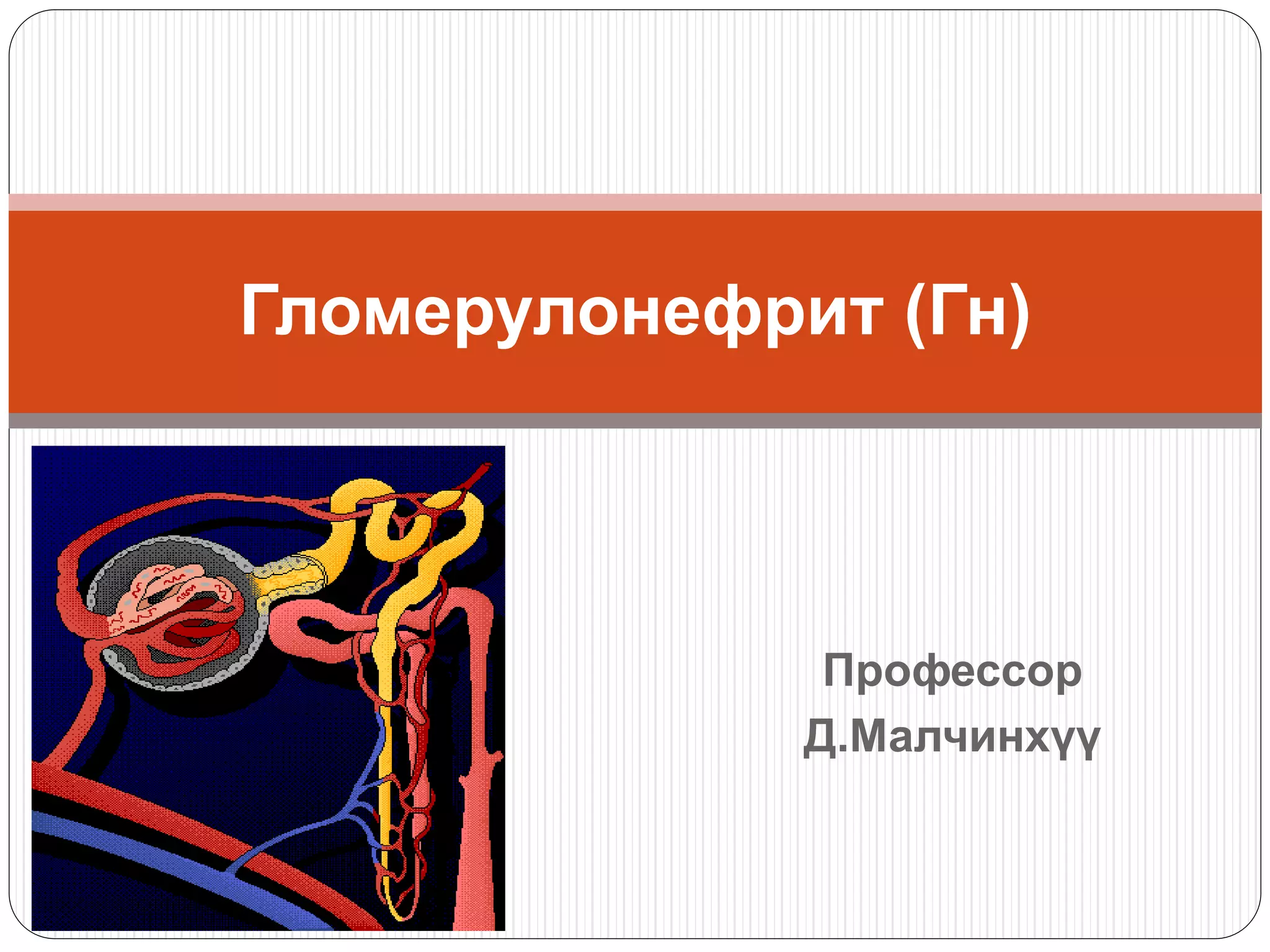 Профессор
Д.Малчинхүү
Гломерулонефрит (Гн)
 
