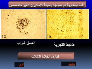 ‫متخصص‬ ‫الغير‬ ‫األستيريز‬ ‫بصبغة‬ ‫صبغها‬ ‫تم‬ ‫ليمفاوية‬ ‫غدة‬
‫ضابط‬‫التجربة‬‫العسل‬‫شراب‬
‫ضعيف‬‫قوى‬
‫اآلكالت‬ ‫الخاليا‬ ‫تفاعل‬
 