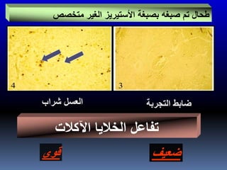 ‫متخصص‬ ‫الغير‬ ‫األستيريز‬ ‫بصبغة‬ ‫صبغه‬ ‫تم‬ ‫طحال‬
‫ضابط‬‫التجربة‬
‫ضعيف‬‫قوى‬
‫العسل‬‫شراب‬
‫اآلكالت‬ ‫الخاليا‬ ‫تفاعل‬
 