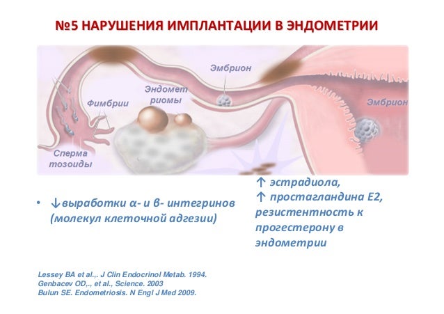 Почему не происходит имплантация. Почему не происходит имплантация