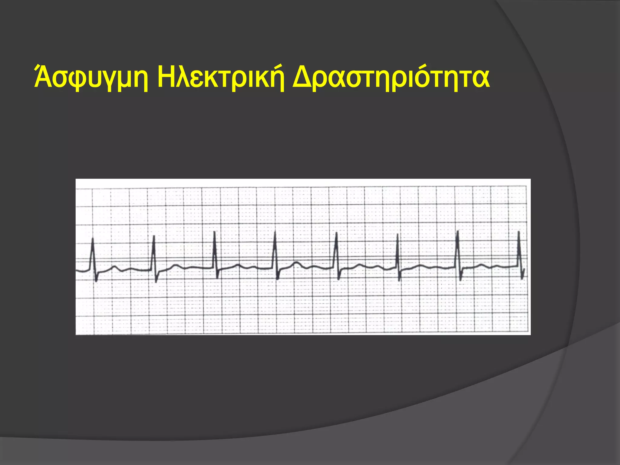 Άσφυγμη Ηλεκτρική Δραστηριότητα
 