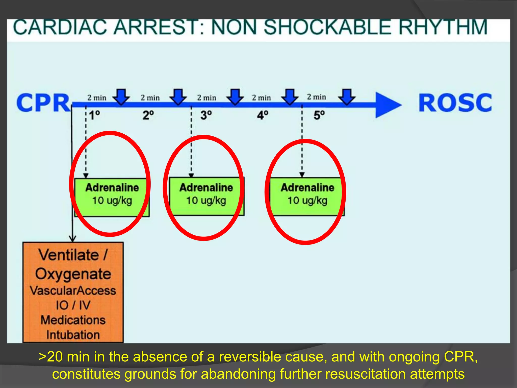 >20 min in the absence of a reversible cause, and with ongoing CPR,
constitutes grounds for abandoning further resuscitation attempts
 
