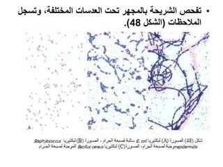 •‫وتسز‬ ،‫المختلسة‬ ‫العدسا‬ ‫تح‬ ‫بالمزةر‬ ‫الشريحة‬ ‫تسح‬
‫المالحظا‬(‫الشك‬48.)
 