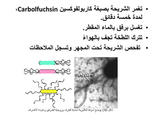 •‫بصبغة‬ ‫الشريحة‬ ‫تغمر‬‫كاربولسوكسين‬Carbolfuchsin،
‫دناةق‬ ‫خمسة‬ ‫لمد‬.
•‫المقور‬ ‫بالماو‬ ‫برفق‬ ‫تغس‬.
•‫تزف‬ ‫اللوخة‬ ‫تترك‬ً‫و‬‫بالةوا‬
•‫وتسز‬ ‫المزةر‬ ‫تح‬ ‫الشريحة‬ ‫تسح‬‫المالحظا‬
 