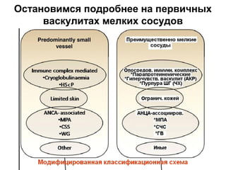 Остановимся подробнее на первичных
васкулитах мелких сосудов
 