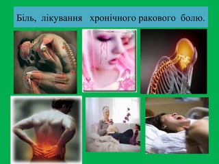 Біль, лікування хронічного ракового болю.
 