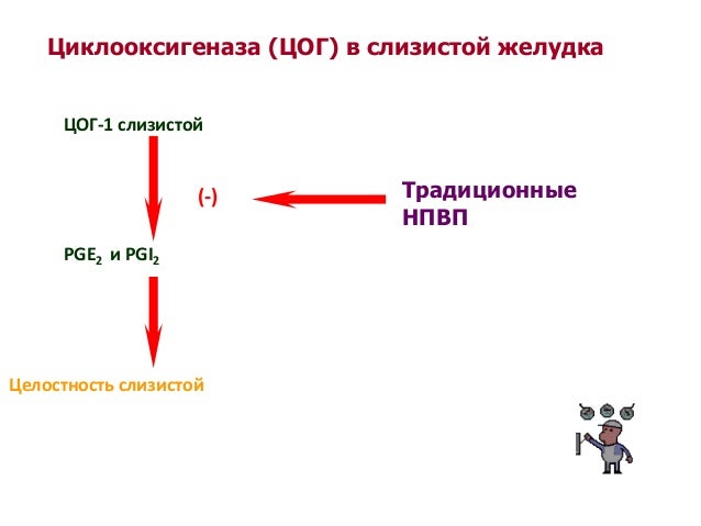 НПВС