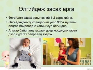 Өлгийдөж засах арга
• Өлгийдөж засах аргыг эхний 1-2 сард хийнэ.
• Өлгийдөхдөө түнх өвдөгний үеэр 90°-т нугалан
алцгар байрлалд 2 хөлийг сул өлгийднө.
• Алцгар байрлалд ташаан дээр мордуулж гаран
дээр суулгах байрлалд тэврэх
 
