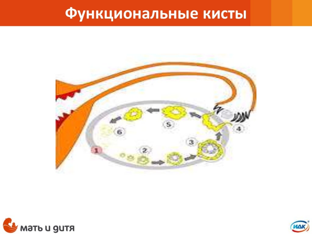 Кия яичников что