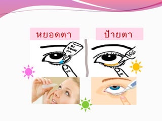 หยอดตา ป้ายตา
 