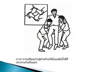 ภาพการ๶คลื่อนย้ายผู้ป่วยด้วยวิธีนั่งบนมือทั้งสี่ที่
ประสานกันเป็นแคร่
 