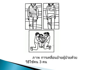 ภาพการ๶คลื่อนย้ายผู้ป่วยด้วย
วิธีใช้คน 3 คน
 