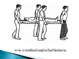 ภาพการ๶คลื่อนย้ายผู้ป่วยโดยใช้เปลหาม
 