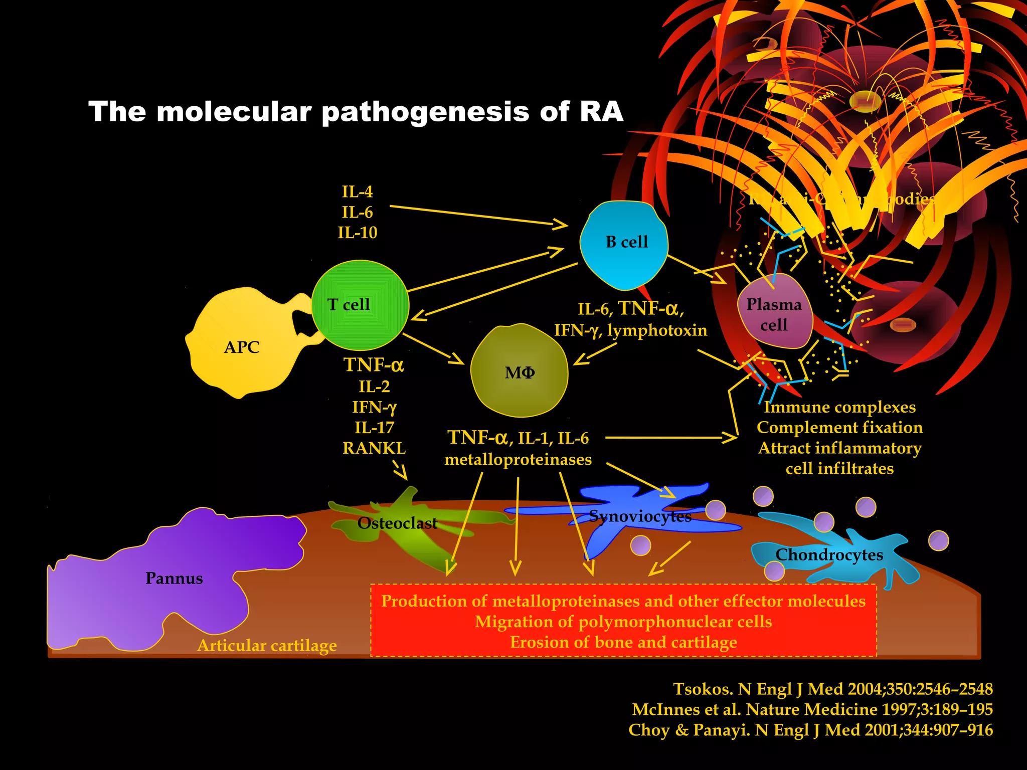 The molecular pathogenesis of RA
Tsokos. N Engl J Med 2004;350:2546–2548
McInnes et al. Nature Medicine 1997;3:189–195
Choy & Panayi. N Engl J Med 2001;344:907–916
Immune complexes
Complement fixation
Attract inflammatory
cell infiltrates
TNF-α, IL-1, IL-6
metalloproteinases
TNF-α
IL-2
IFN-γ
IL-17
RANKL
Articular cartilage
Production of metalloproteinases and other effector molecules
Migration of polymorphonuclear cells
Erosion of bone and cartilage
Pannus
Osteoclast Synoviocytes
Chondrocytes
MΦ
IL-4
IL-6
IL-10
RF, anti-CCP antibodies
IL-6, TNF-α,
IFN-γ, lymphotoxin
Plasma
cell
B cell
T cell
APC
 