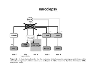 narcolepsy
 