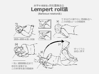 Lempert roll法
⽔平半規管型の⽿⽯置換法②
(Barbecue rotation法)
頭部を健側45度に回旋
できるだけ速やかに患側臥位へ
この状態を2〜3分間維持.
ゆっくりと
坐位に戻す.
⼀気に健側側臥位まで
体位を変換する....