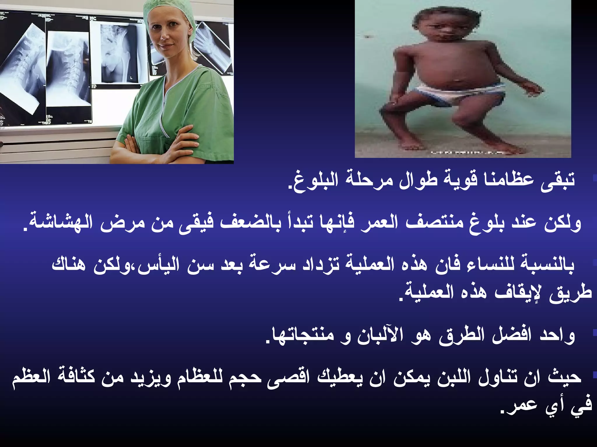 .‫البلوغ‬ ‫مرحلة‬ ‫طوال‬ ‫قوية‬ ‫عظامنا‬ ‫تبقى‬
‫بالضعف‬ ‫تبدأ‬ ‫فإنها‬ ‫العمر‬ ‫منتصف‬ ‫بلوغ‬ ‫عند‬ ‫ولكن‬‫الهشاشة‬ ‫مرض‬ ‫من‬ ‫فيقى‬.
‫هناك‬ ‫اليأس،ولكن‬ ‫سن‬ ‫بعد‬ ‫سرعة‬ ‫تزداد‬ ‫العملية‬ ‫هذه‬ ‫فان‬ ‫للنساء‬ ‫بالنسبة‬
.‫العملية‬ ‫هذه‬ ‫ليقاف‬ ‫طريق‬
‫هو‬ ‫الطرق‬ ‫افضل‬ ‫واحد‬‫منتجاتها‬ ‫و‬ ‫اللبان‬.
‫تناول‬ ‫ان‬ ‫حيث‬‫اللبن‬‫العظم‬ ‫كثافة‬ ‫من‬ ‫ويزيد‬ ‫للعظام‬ ‫حجم‬ ‫اقصى‬ ‫يعطيك‬ ‫ان‬ ‫يمكن‬
.‫عمر‬ ‫أي‬ ‫في‬
 