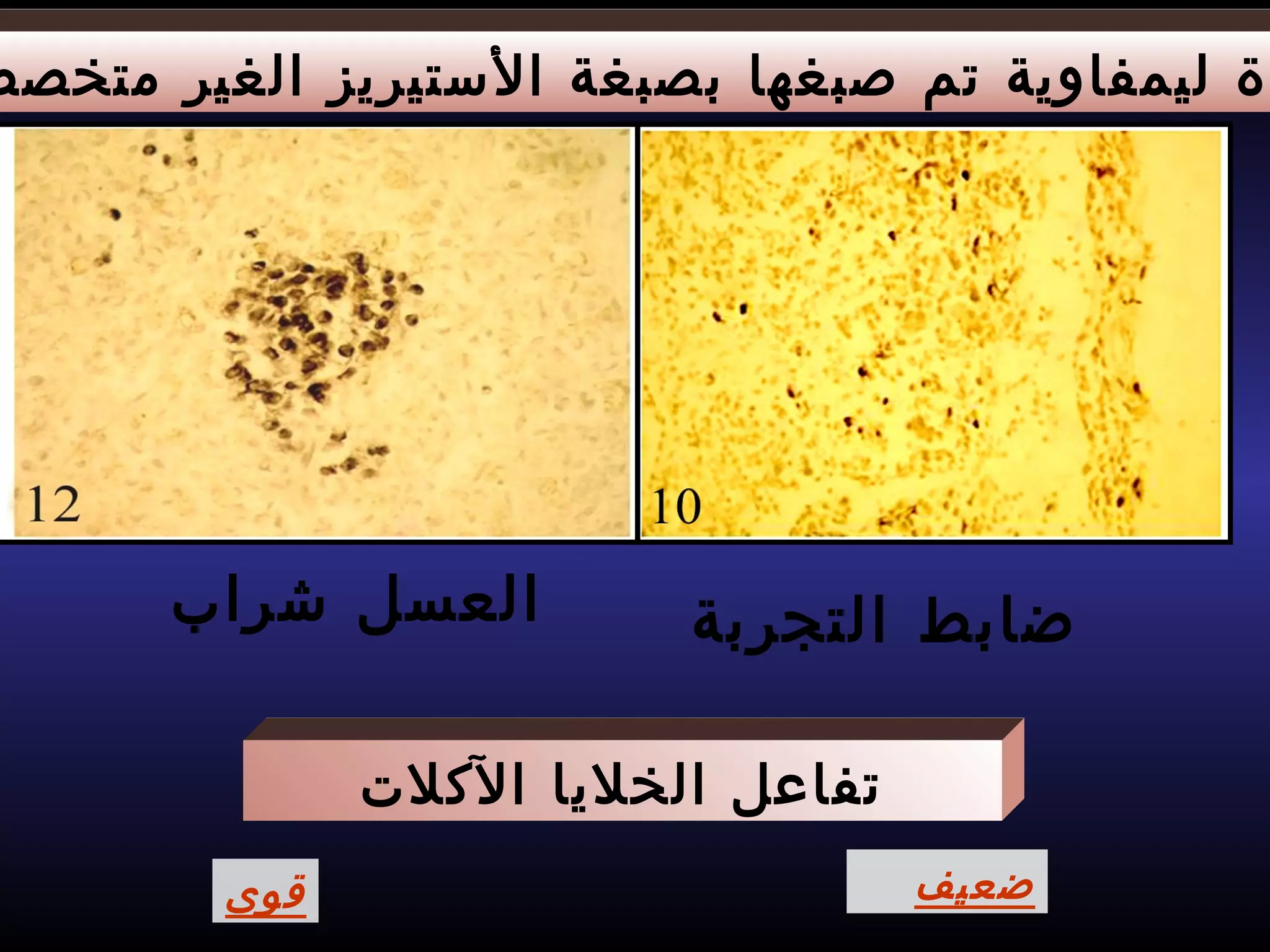 ‫متخصص‬ ‫الغير‬ ‫الستيريز‬ ‫بصبغة‬ ‫صبغها‬ ‫تم‬ ‫ليمفاوية‬ ‫دة‬
‫ضابط‬‫التجربة‬‫العسل‬‫شراب‬
‫ضعيف‬‫قوى‬
‫الكلت‬ ‫الخليا‬ ‫تفاعل‬
 