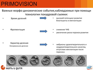 • Время делений
• Фрагментация
• Характер деления
Ненормальное деление
Важные морфо-динамические события,наблюдаемые при помощи
технологии покадровой съемки:
• высокий потенциал развития
бластоцисты и имплантации
• снижение ЧНБ
• увеличение риска пороков развития
• эмбрионы удовлетворительного и
неудовлетворительного качества,
отсутствие имплантации после
переноса
PRIMOVISION
 