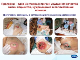 Современные Подходы К Лечению Хронических Ран И Пролежней | PPT