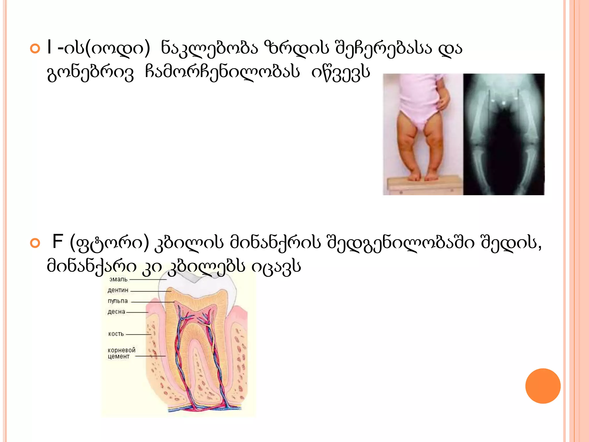  I -ის(იოდი) ნაკლებობა ზრდის შეჩერებასა და
გონებრივ ჩამორჩენილობას იწვევს
 F (ფტორი) კბილის მინანქრის შედგენილობაში შედის,
მინანქარი კი კბილებს იცავს
 