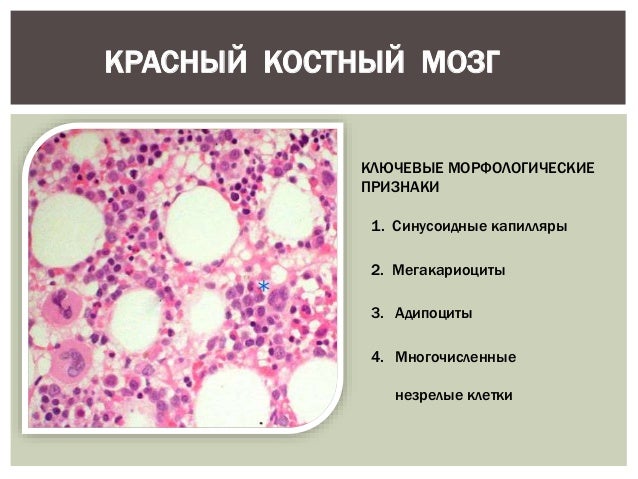красный костный мозг характеристика. характеристики красного костного мозга. роль красного костного мозга. структурные компоненты красного костного мозга. структура красного костного мозга иммунология.