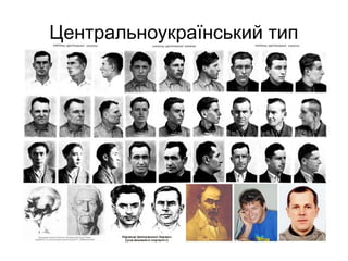 Центральноукраїнський тип
 