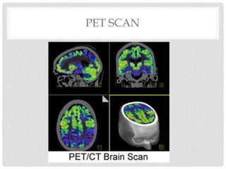 PET SCAN
 
