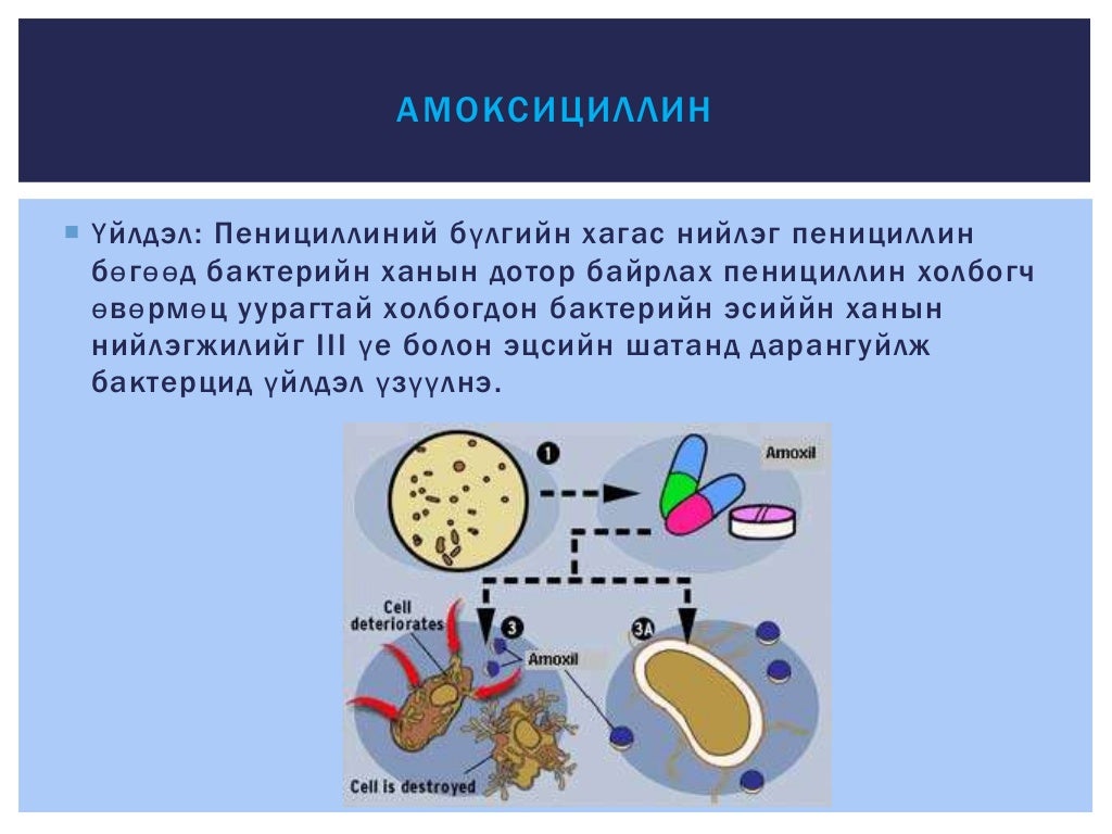 Зайлшгүй шаардлагатай антибиотик
